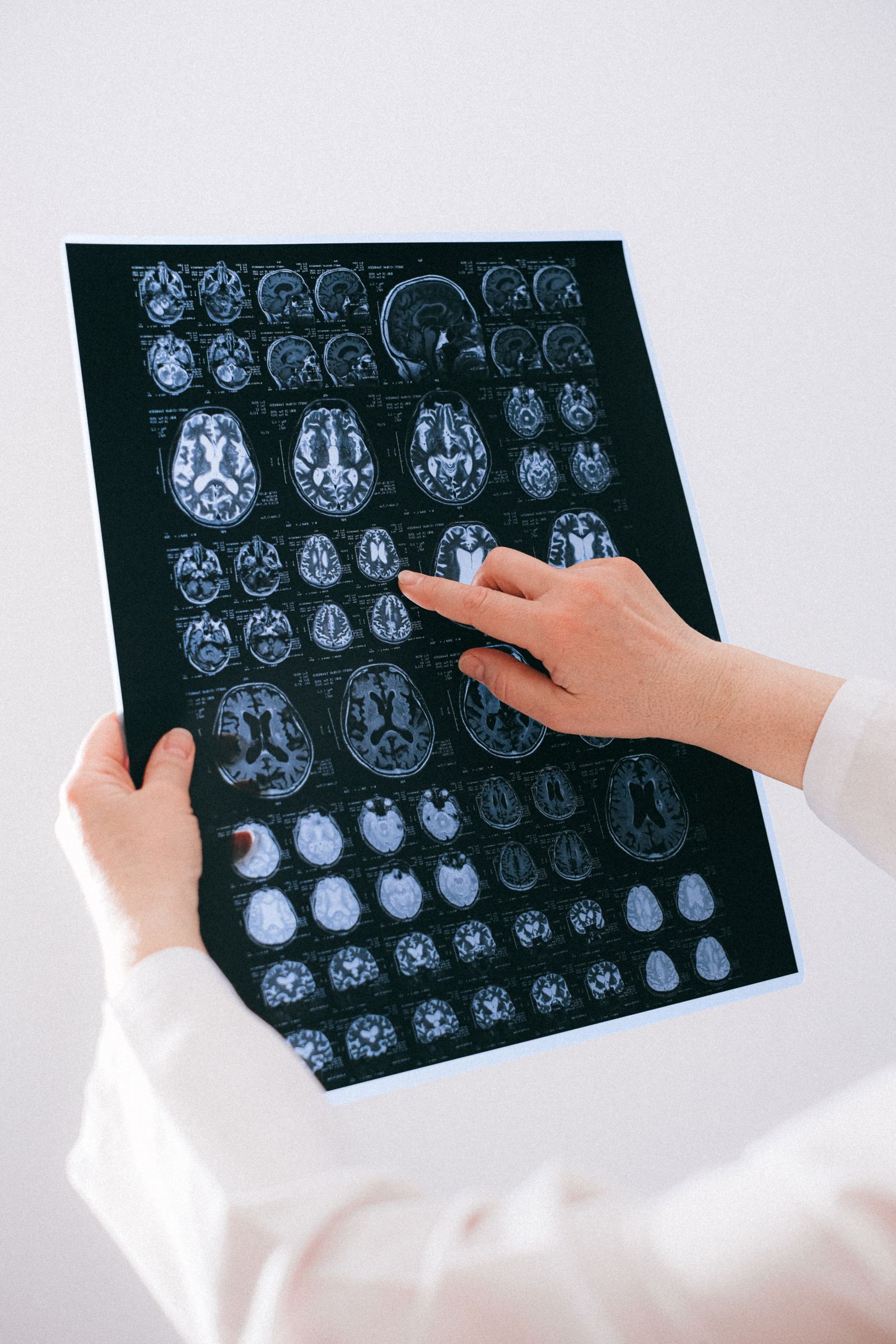 A doctor examining a film with a series of brain MRI scans